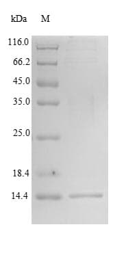 Human PH / PAH Protein (Recombinant 6His-SUMO, N-terminus)