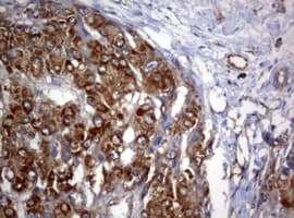 Monoclonal Mouse anti-Human PIK3C2A Antibody (clone OTI2D9, aa230-560, IHC, WB)