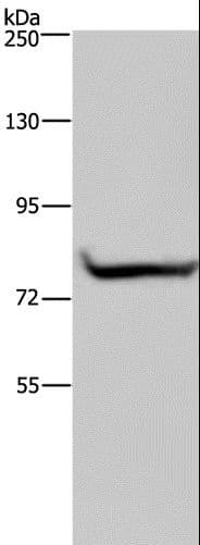 Polyclonal Rabbit anti-Human GYS1 / Glycogen Synthase Antibody (IHC, WB)