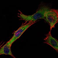 HK1 / Hexokinase 1 Antibody (clone 7A7)