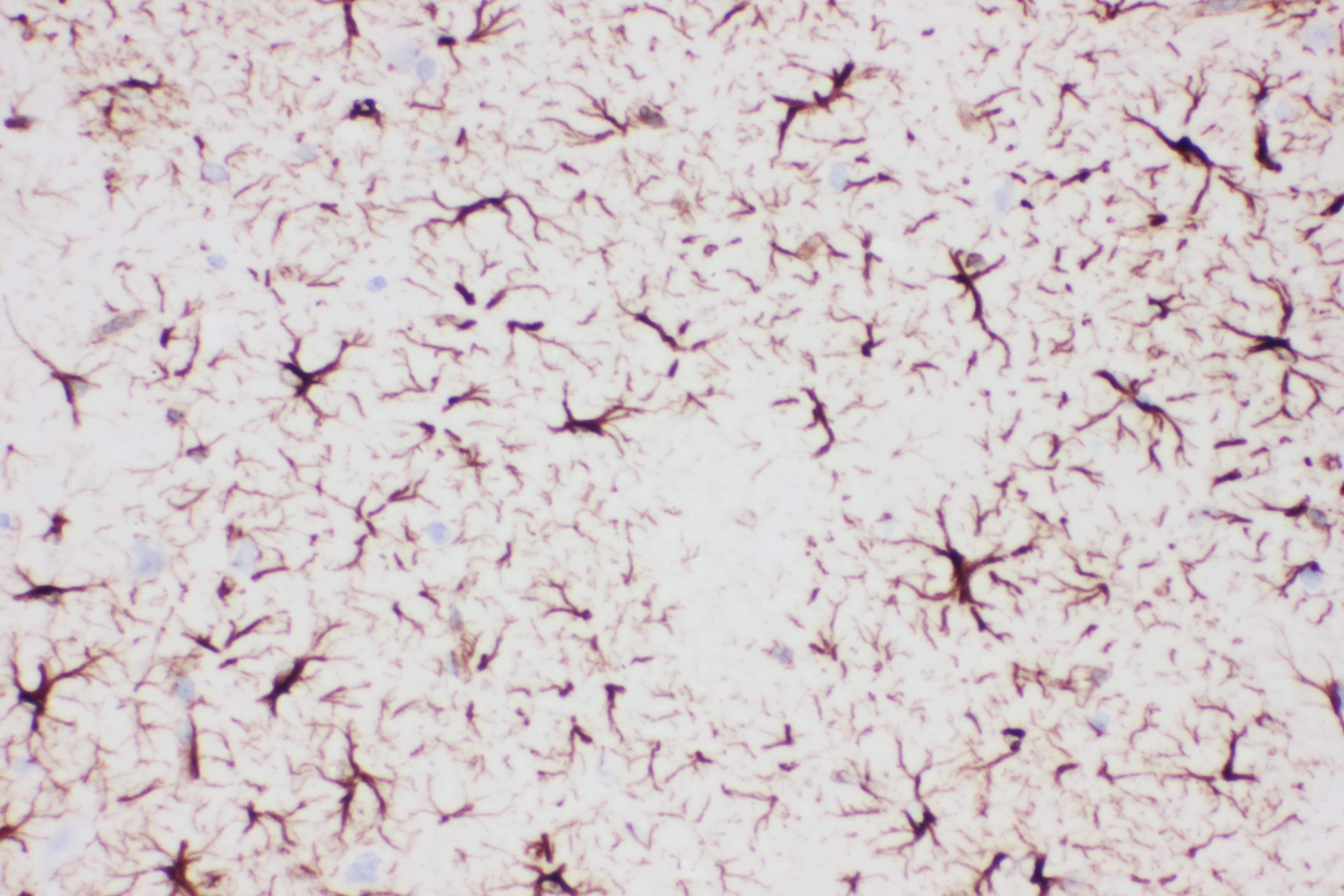 GFAP Antibody (aa93-432)
