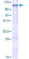 Human PCIF1 Protein (Recombinant GST)