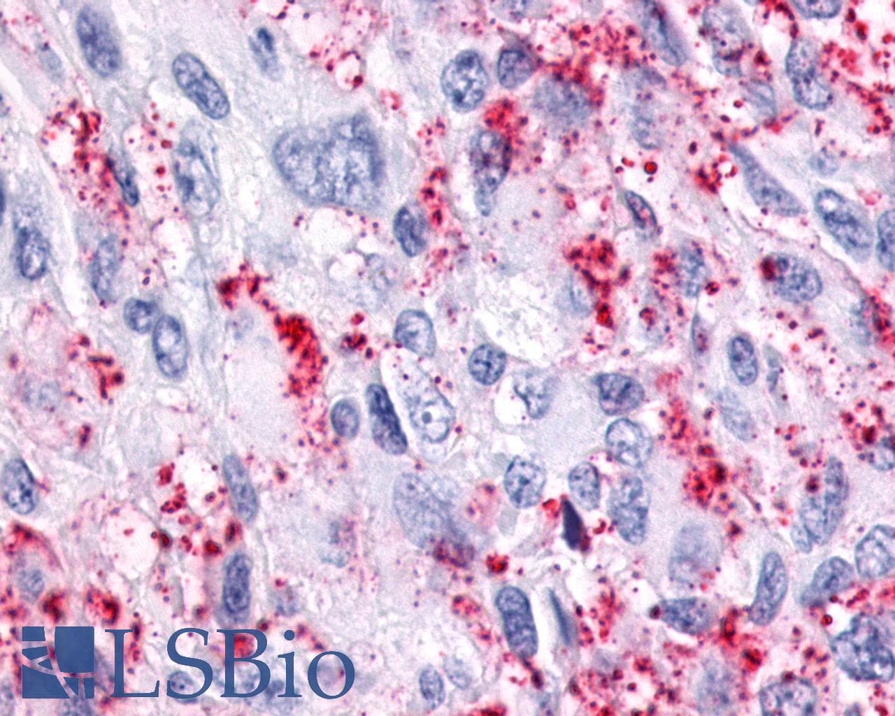PathPlus™ ADGRF5 / GPR116 Antibody (N-Terminus)