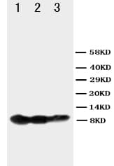 BAFF Receptor / CD268 Antibody (aa1-15)