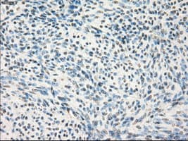 MAP2K1 / MKK1 / MEK1 Antibody (clone OTI1C1, Carrier-free)