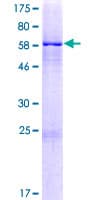 Human ZIK1 Protein (Recombinant GST)