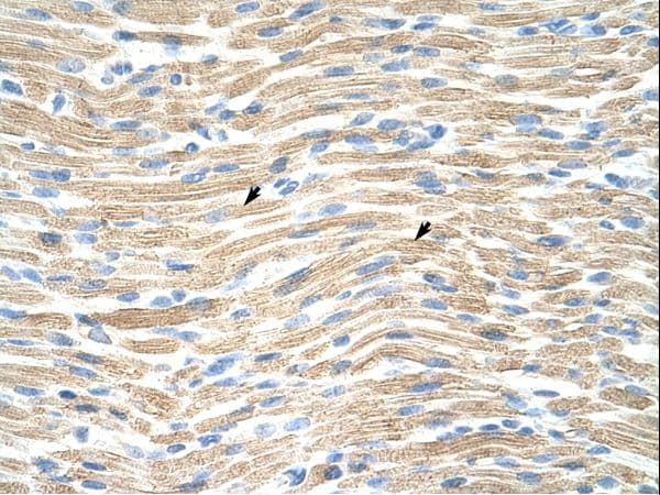 Polyclonal Rabbit anti-Human LMX1A Antibody (FITC, aa244-293, IHC, WB)