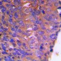 Polyclonal Rabbit anti-Human CBR / CBR1 Antibody (Internal, IHC, IF, WB)