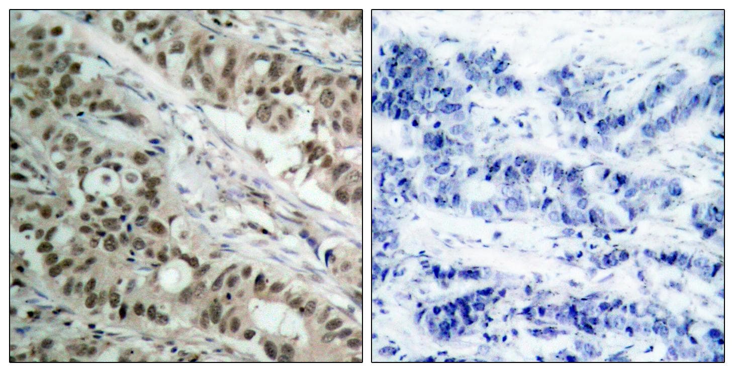 Polyclonal Rabbit anti-Human FOXO1 / FKHR Antibody (p256, IHC, WB)