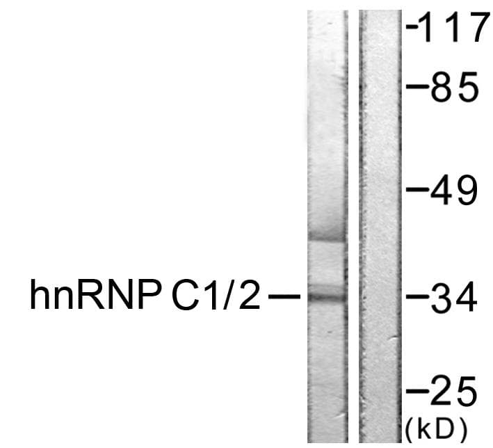 HNRNPC / HNRNP C Antibody (p260)