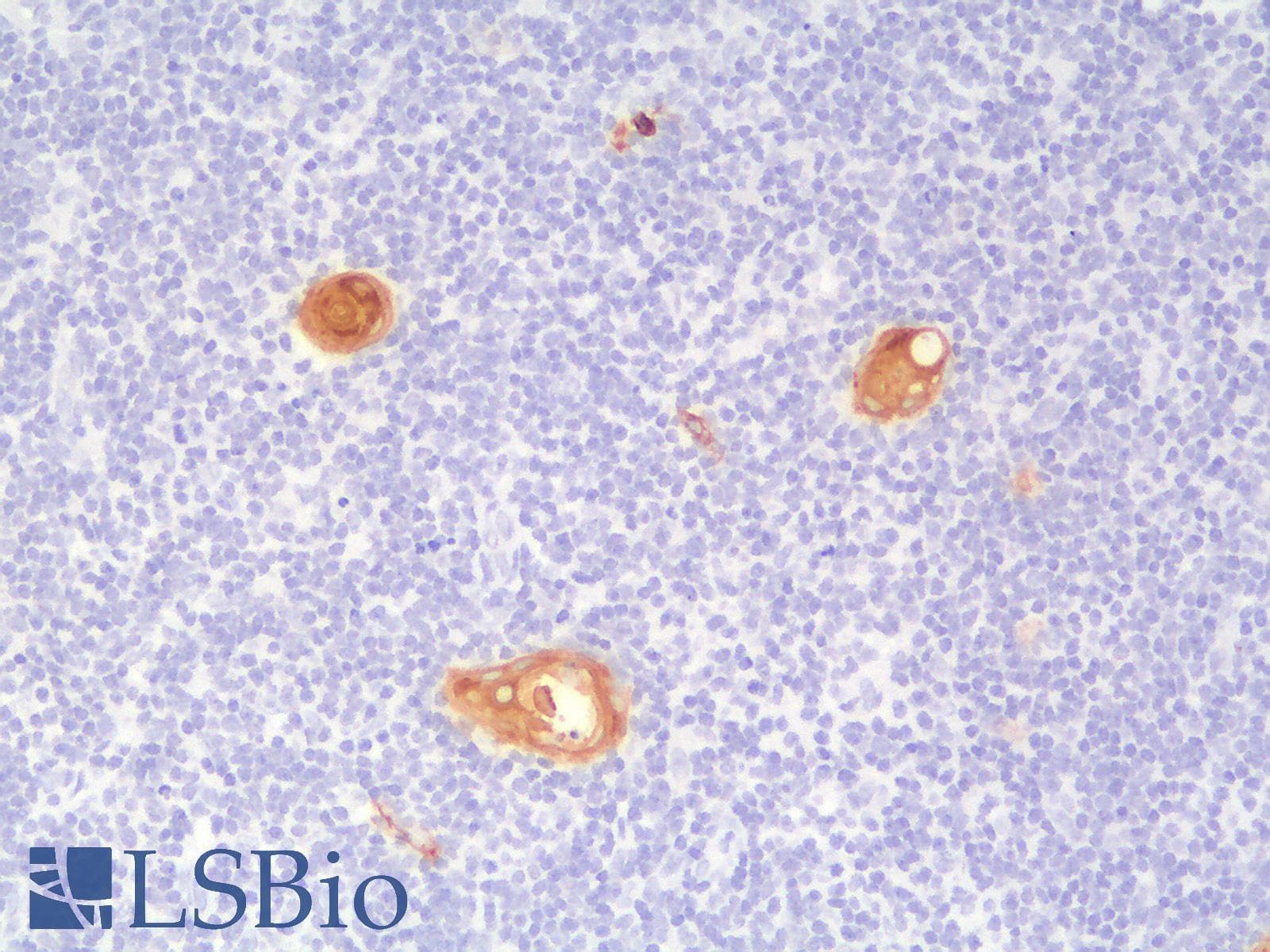PathPlus™ KRT10 / CK10 / Cytokeratin 10 Antibody (clone KRT10/1990R)