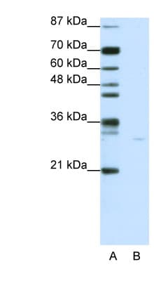 AIFM1 / AIF / PDCD8 Antibody (aa211-260)