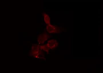 FAK / Focal Adhesion Kinase Antibody (phospho-Tyr397)