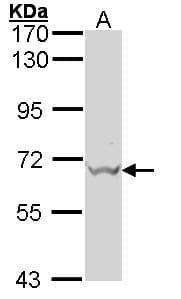 GAD1 / GAD67 Antibody (aa5-216)