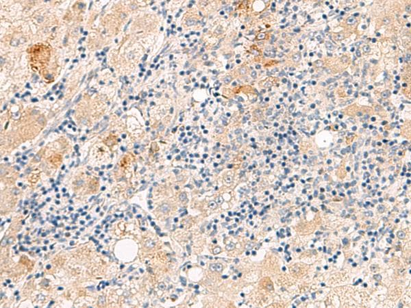 Polyclonal Rabbit anti-Human THNSL1 Antibody (IHC, WB)