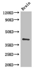 Polyclonal Rabbit anti-Human CD34 Antibody (IHC, IF, WB)