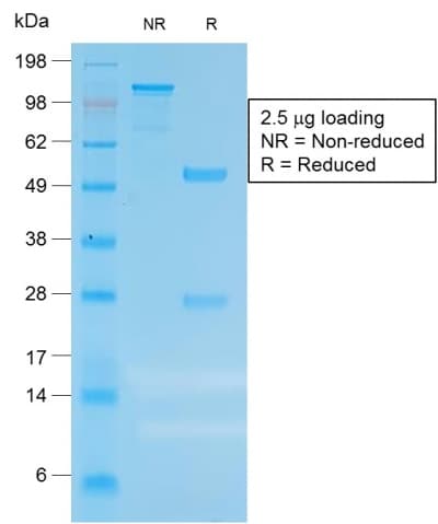Recombinant Monoclonal Rabbit anti-Human CEACAM1,5 Antibody (clone C66/1983R, Azide-free,Carrier-free, IHC)