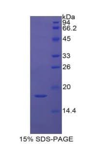KRT1 / CK1 / Cytokeratin 1 Protein (Recombinant His)