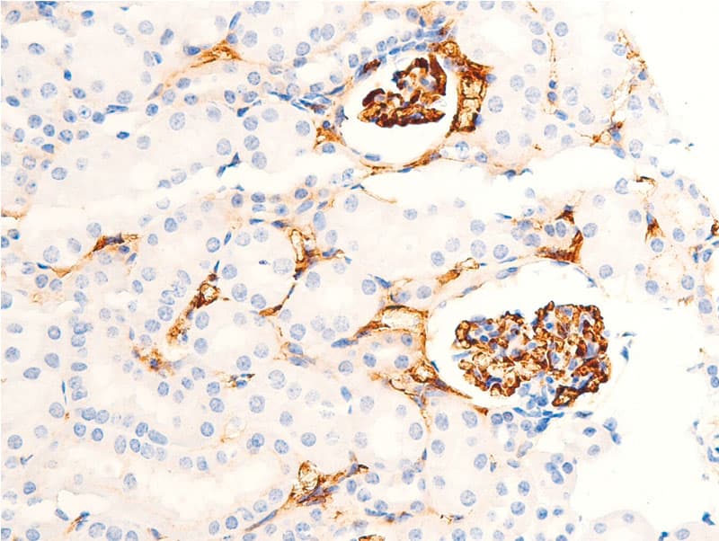 CHEK1 / CHK1 Antibody (phospho-Ser301)