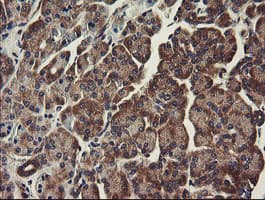 UBE2J1 Antibody (clone OTI3E6)