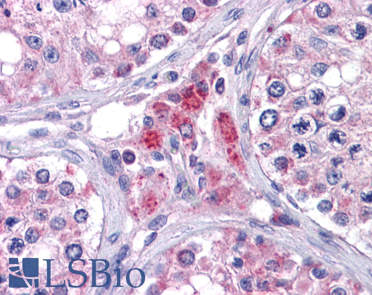 IHC-plus™ EYA4 Antibody (aa2-16)