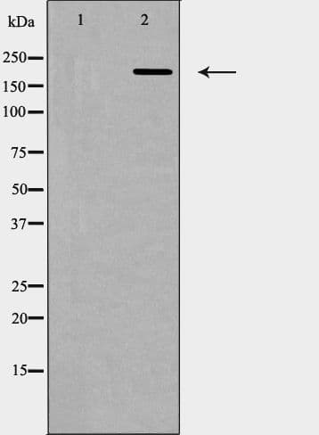 TP53BP1 / 53BP1 Antibody