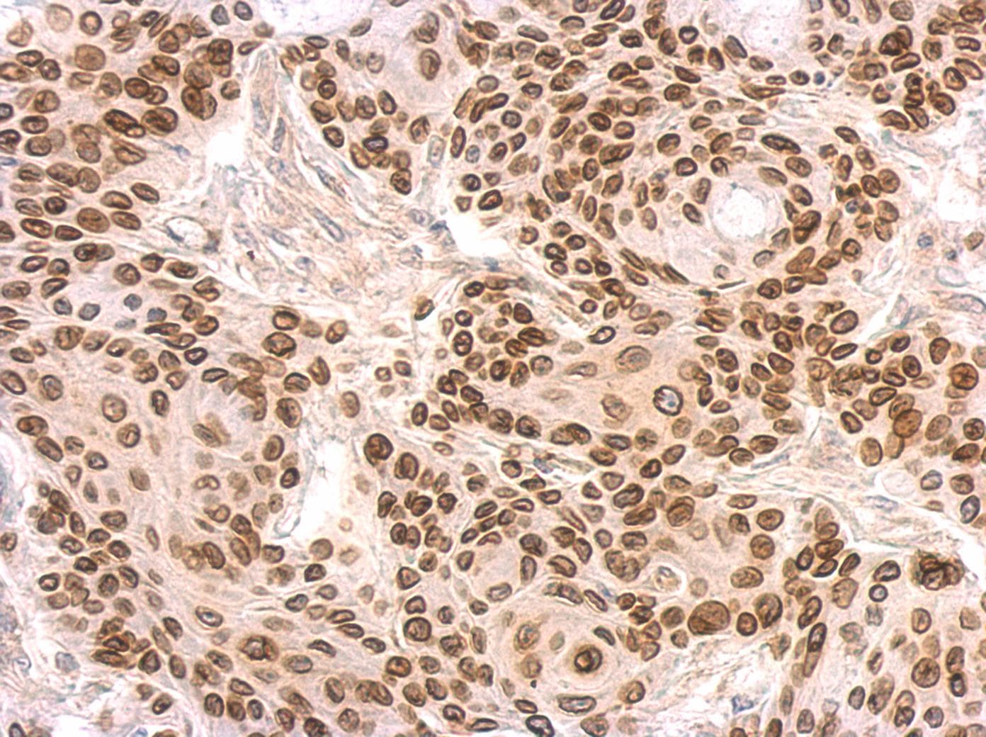 LMNB2 / Lamin B2 Antibody (aa221-500)