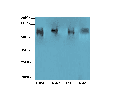 CFAP52 / WDR16 Antibody