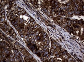 SKIL / SNO / SnoN Antibody (clone OTI2C9)