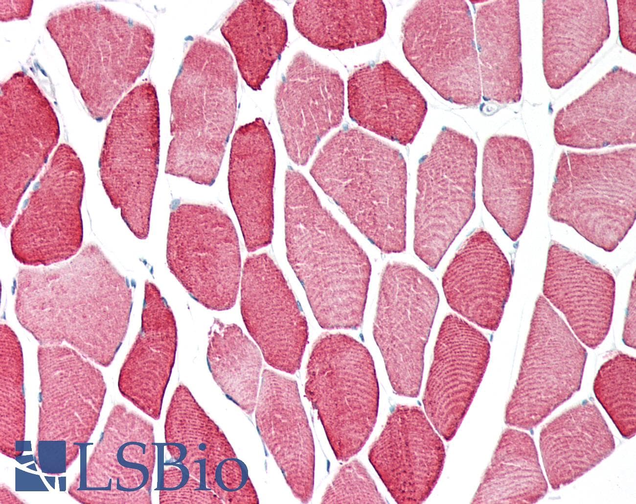 IHC-plus™ Polyclonal Rabbit anti-Human TPM3 Antibody (IHC, IF, WB)