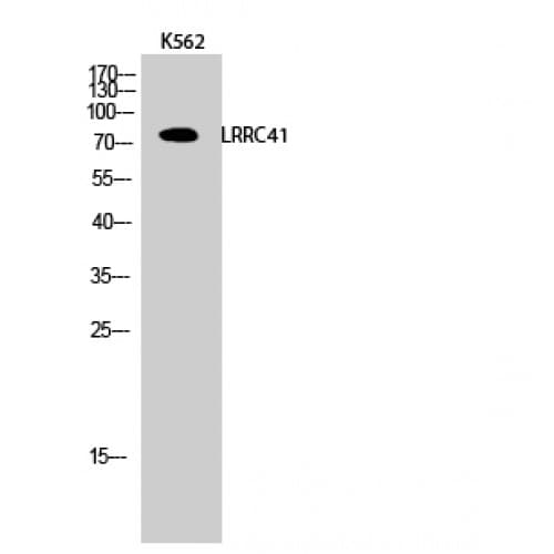 LRRC41 Antibody (360-440 aa, Internal)