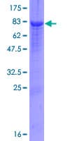 Human SERPINF2 / Alpha-2-Antiplasmin Protein (Recombinant GST)