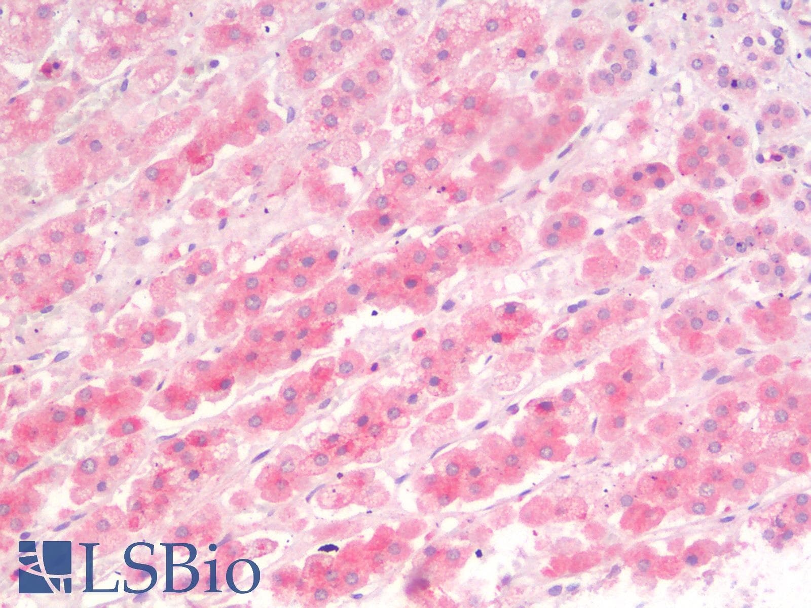 PathPlus™ SLC40A1 / Ferroportin-1 Antibody