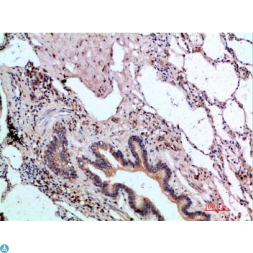 ASCL1 / MASH1 Antibody