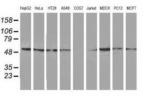 Monoclonal Mouse anti-Human GSS / Glutathione Synthetase Antibody (clone OTI2G3, WB)
