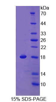 Human RGCC Protein (Recombinant His)