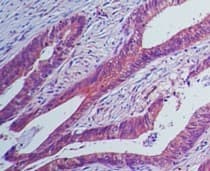 Monoclonal Mouse anti-Human IL23R Antibody (clone 15N6C6, Azide-free, aa288-315, IHC, WB)