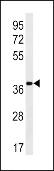 GPR80 / GPR99 / OXGR1 Antibody (aa309-337)