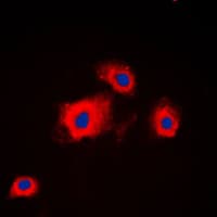 PI3K Alpha+Gamma Antibody (Internal)