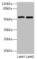 Polyclonal Rabbit anti-Human TSAP6 / STEAP3 Antibody (IHC, WB)
