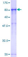 Human RPN1 / Ribophorin I Protein (Recombinant GST)