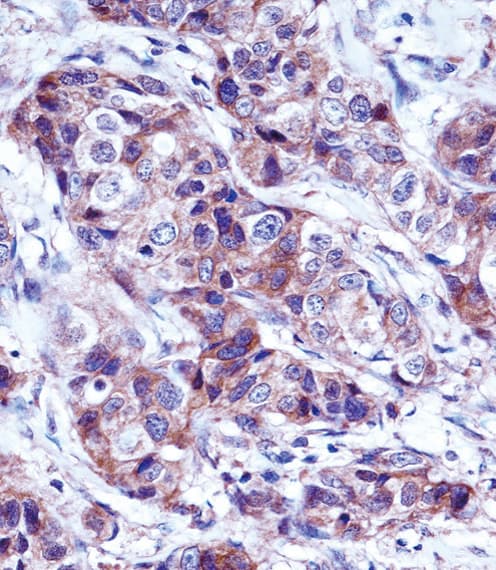 Polyclonal Rabbit anti-Human LALBA / Alpha Lactalbumin Antibody (aa39-68, IHC, WB)