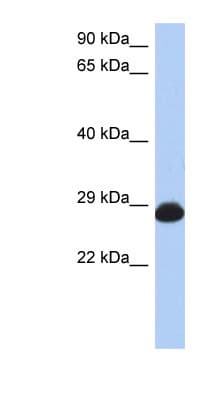 RAB39B Antibody (N-Terminus)