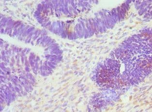 CTCF Antibody (aa1-260)
