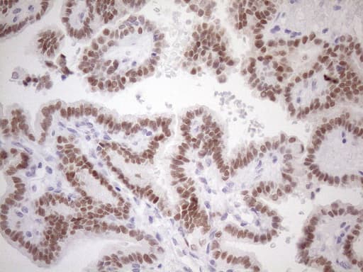 Monoclonal Mouse anti-Human ATF1 Antibody (clone OTI2C2, IHC, WB)