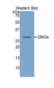 LOXL1 Antibody (aa393-603, Biotin)