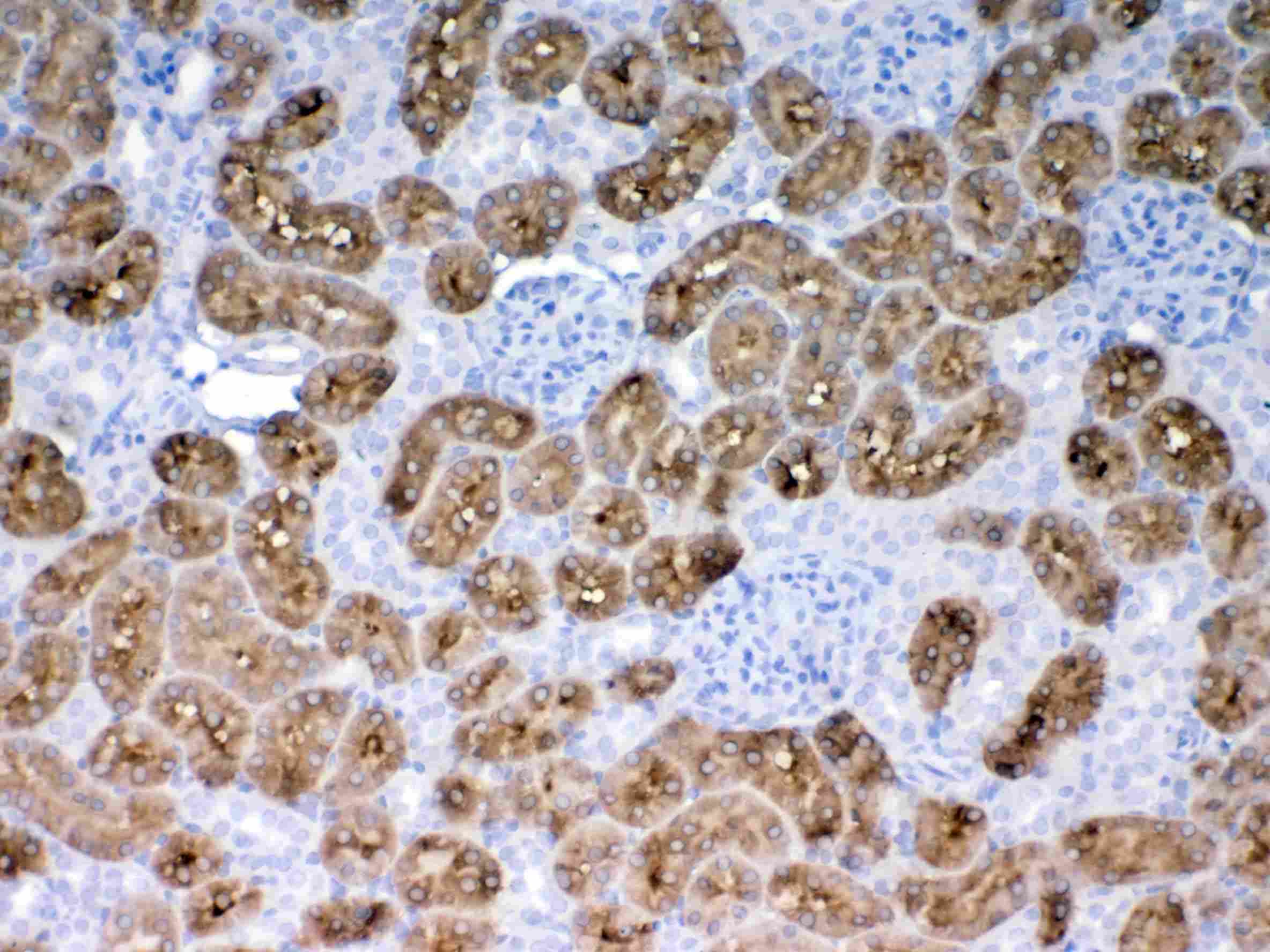 PH / PAH Antibody