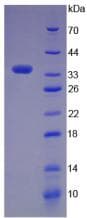 Human Complement C5a Protein (Recombinant GST)