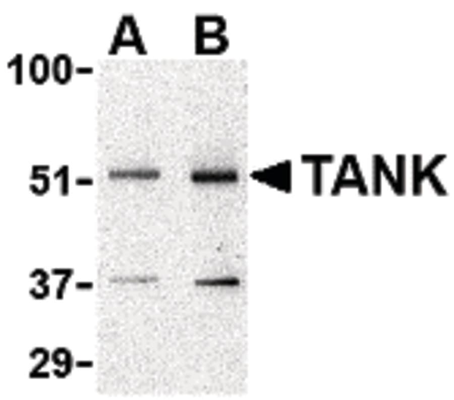 IHC-plus™ Polyclonal Rabbit anti-Human TANK Antibody (IHC, WB)