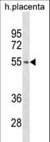 Polyclonal Rabbit anti-Human TARBP2 / TRBP2 Antibody (aa60-89, IHC, WB)